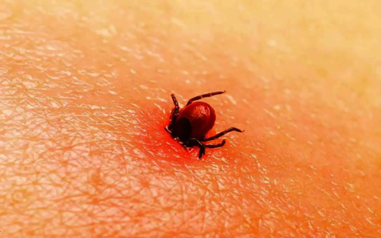 Metodi naturali per rimuovere gli acari dal materasso senza l’uso di prodotti chimici Immagine selezionata