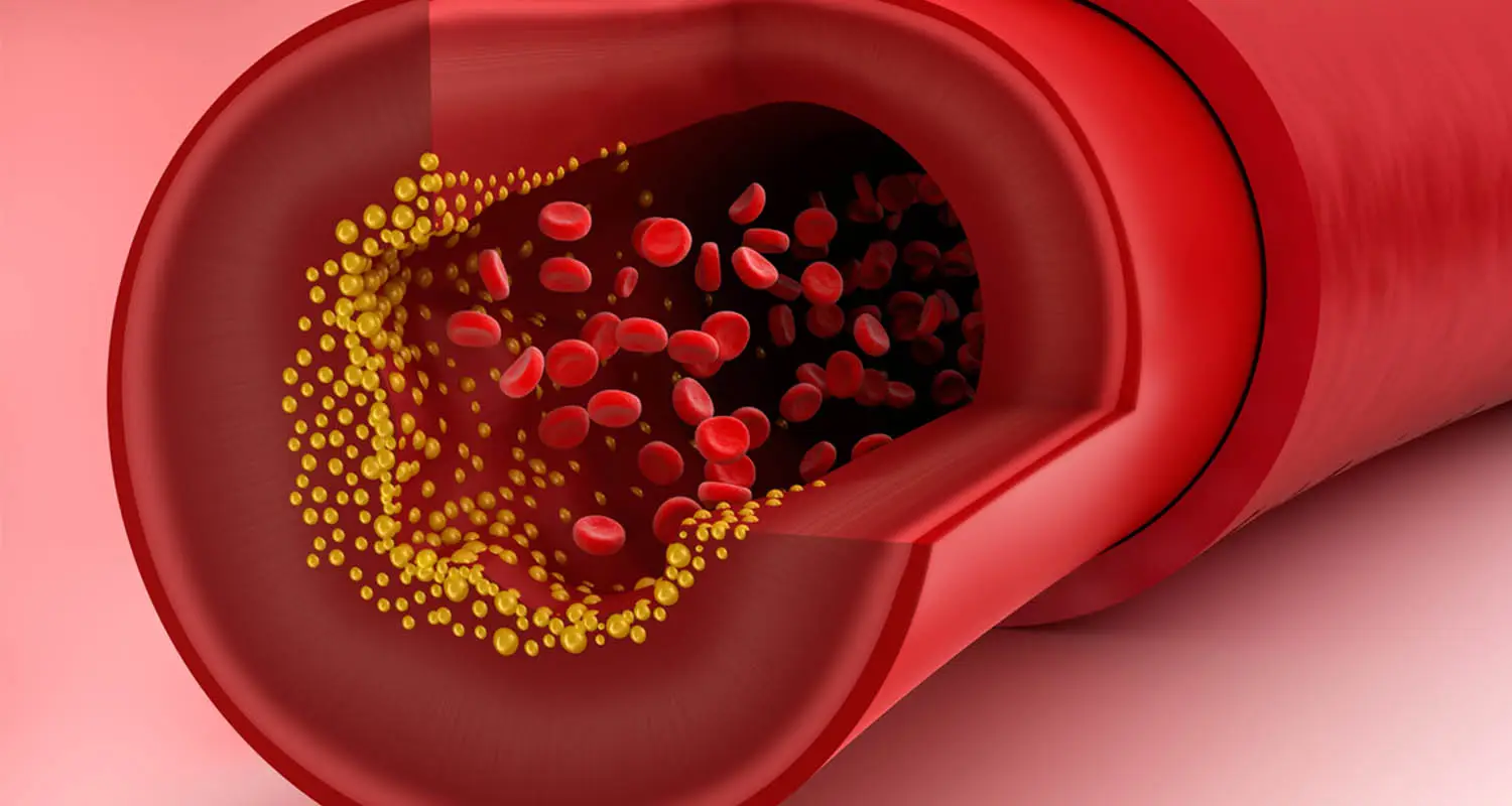 L’alimento che pulisce le arterie: lo trovi facilmente al supermercato L’alimento che pulisce le arterie: lo trovi facilmente al supermercato